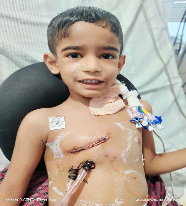 MICS-ASD - Dr. Kishor Deore